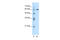 PDZ And LIM Domain 5 antibody, 28-945, ProSci, Western Blot image 