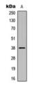 Casein Kinase 1 Alpha 1 antibody, orb393259, Biorbyt, Western Blot image 