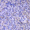 Deoxythymidylate Kinase antibody, LS-C334667, Lifespan Biosciences, Immunohistochemistry frozen image 