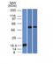TOX High Mobility Group Box Family Member 3 antibody, M06035, Boster Biological Technology, Western Blot image 