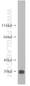 Coenzyme Q5, Methyltransferase antibody, 17453-1-AP, Proteintech Group, Western Blot image 