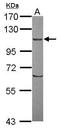 Oxysterol Binding Protein Like 8 antibody, GTX121273, GeneTex, Western Blot image 