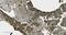 Poly(ADP-Ribose) Polymerase 1 antibody, M00122-5, Boster Biological Technology, Immunohistochemistry paraffin image 