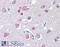 Fasciculation And Elongation Protein Zeta 1 antibody, 45-586, ProSci, Western Blot image 