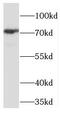 PHD Finger Protein 21A antibody, FNab06386, FineTest, Western Blot image 