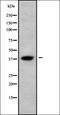 Acyl-CoA Wax Alcohol Acyltransferase 2 antibody, orb337945, Biorbyt, Western Blot image 