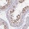 Adenosine Deaminase TRNA Specific 3 antibody, NBP2-31732, Novus Biologicals, Immunohistochemistry paraffin image 