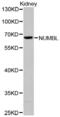 NUMB Like Endocytic Adaptor Protein antibody, abx001752, Abbexa, Western Blot image 