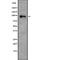 Transforming Growth Factor Beta Receptor 3 antibody, abx218959, Abbexa, Western Blot image 