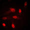 Serum/Glucocorticoid Regulated Kinase 1 antibody, LS-C352829, Lifespan Biosciences, Immunofluorescence image 