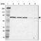 Telomeric Repeat Binding Factor 2 antibody, HPA001907, Atlas Antibodies, Western Blot image 