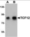 Transcription Factor 12 antibody, orb94591, Biorbyt, Western Blot image 