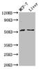 AKT Serine/Threonine Kinase 2 antibody, LS-C370815, Lifespan Biosciences, Western Blot image 