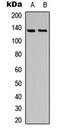 ACK1 antibody, orb304637, Biorbyt, Western Blot image 