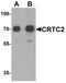 CREB Regulated Transcription Coactivator 2 antibody, PA5-34547, Invitrogen Antibodies, Western Blot image 