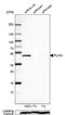 Perilipin-3 antibody, NBP2-49485, Novus Biologicals, Western Blot image 