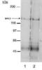 NPC1 Like Intracellular Cholesterol Transporter 1 antibody, PA1-16800, Invitrogen Antibodies, Western Blot image 