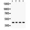 Adiponectin Receptor 1 antibody, LS-C407633, Lifespan Biosciences, Western Blot image 