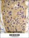 WNT Inhibitory Factor 1 antibody, 61-454, ProSci, Immunohistochemistry paraffin image 