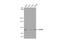 Adenosine Deaminase RNA Specific antibody, GTX629000, GeneTex, Western Blot image 