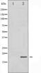 Cofilin 1 antibody, abx010581, Abbexa, Western Blot image 