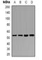 Phosphatase And Tensin Homolog antibody, LS-C368747, Lifespan Biosciences, Western Blot image 