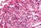 G Protein-Coupled Receptor 182 antibody, MBS244428, MyBioSource, Immunohistochemistry paraffin image 