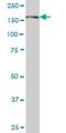 Phosphoinositide-3-Kinase Regulatory Subunit 4 antibody, H00030849-M04, Novus Biologicals, Western Blot image 