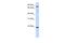 ADP Ribosylation Factor Like GTPase 11 antibody, A11959, Boster Biological Technology, Western Blot image 