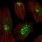 Rhomboid Domain Containing 2 antibody, HPA051960, Atlas Antibodies, Immunofluorescence image 