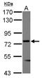 Menin 1 antibody, NBP2-17277, Novus Biologicals, Western Blot image 