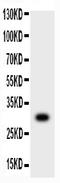 Matrix Metallopeptidase 7 antibody, LS-C313432, Lifespan Biosciences, Western Blot image 