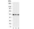 Mitogen-Activated Protein Kinase 13 antibody, R31045, NSJ Bioreagents, Western Blot image 