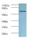 FAS antibody, MBS715594, MyBioSource, Western Blot image 