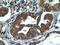 AlkB Homolog 3, Alpha-Ketoglutaratedependent Dioxygenase antibody, 12292-1-AP, Proteintech Group, Immunohistochemistry frozen image 