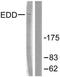 E3 ubiquitin-protein ligase UBR5 antibody, TA315471, Origene, Western Blot image 