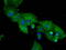 Dipeptidyl Peptidase 4 antibody, M00597-2, Boster Biological Technology, Immunofluorescence image 