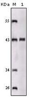 Sortilin Related Receptor 1 antibody, MA5-15355, Invitrogen Antibodies, Western Blot image 