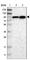 ElaC Ribonuclease Z 2 antibody, HPA019535, Atlas Antibodies, Western Blot image 