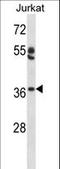 Putative transcription factor Ovo-like 1 antibody, LS-C163299, Lifespan Biosciences, Western Blot image 