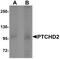 Dispatched RND Transporter Family Member 3 antibody, PA5-72748, Invitrogen Antibodies, Western Blot image 