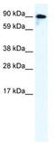 Glutamate Ionotropic Receptor Kainate Type Subunit 2 antibody, TA338703, Origene, Western Blot image 