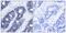 Insulin Receptor Substrate 1 antibody, GTX50550, GeneTex, Immunohistochemistry paraffin image 