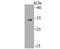 Methyl-CpG Binding Domain Protein 3 antibody, A02571-1, Boster Biological Technology, Western Blot image 