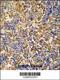 Inhibitor Of Bruton Tyrosine Kinase antibody, 55-375, ProSci, Immunohistochemistry frozen image 