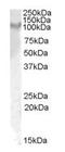 Interleukin 17 Receptor A antibody, LS-C108120, Lifespan Biosciences, Western Blot image 