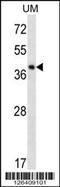 Speckle Type BTB/POZ Protein Like antibody, 56-633, ProSci, Western Blot image 