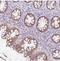 Collagen Type IX Alpha 2 Chain antibody, NBP2-30450, Novus Biologicals, Immunohistochemistry frozen image 