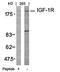 Insulin Like Growth Factor 1 antibody, orb14492, Biorbyt, Western Blot image 