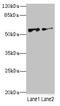NIMA Related Kinase 3 antibody, LS-C676145, Lifespan Biosciences, Western Blot image 